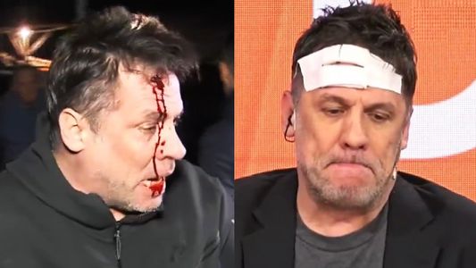 El video del brutal botellazo en la cabeza a un cronista de Desayuno Americano en el cierre de Javier Milei