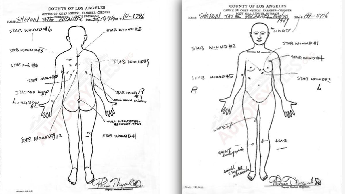 La ficha forense con todos los ataques a cuchillazos que acabaron con la vida de Sharon Tate y el bebé que llevaba en su útero. (Foto: Gentileza MTTS)