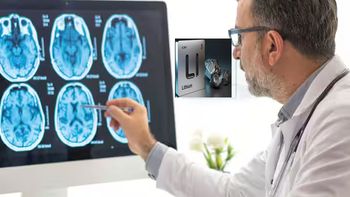 Avance revolucionario: descubren un mineral que podría ser clave para curar el Alzheimer
