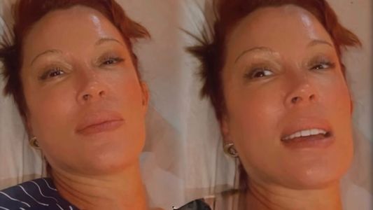 Miriam Lanzoni habló de su complicada lucha contra la psoriasis y conmovió con una frase clave