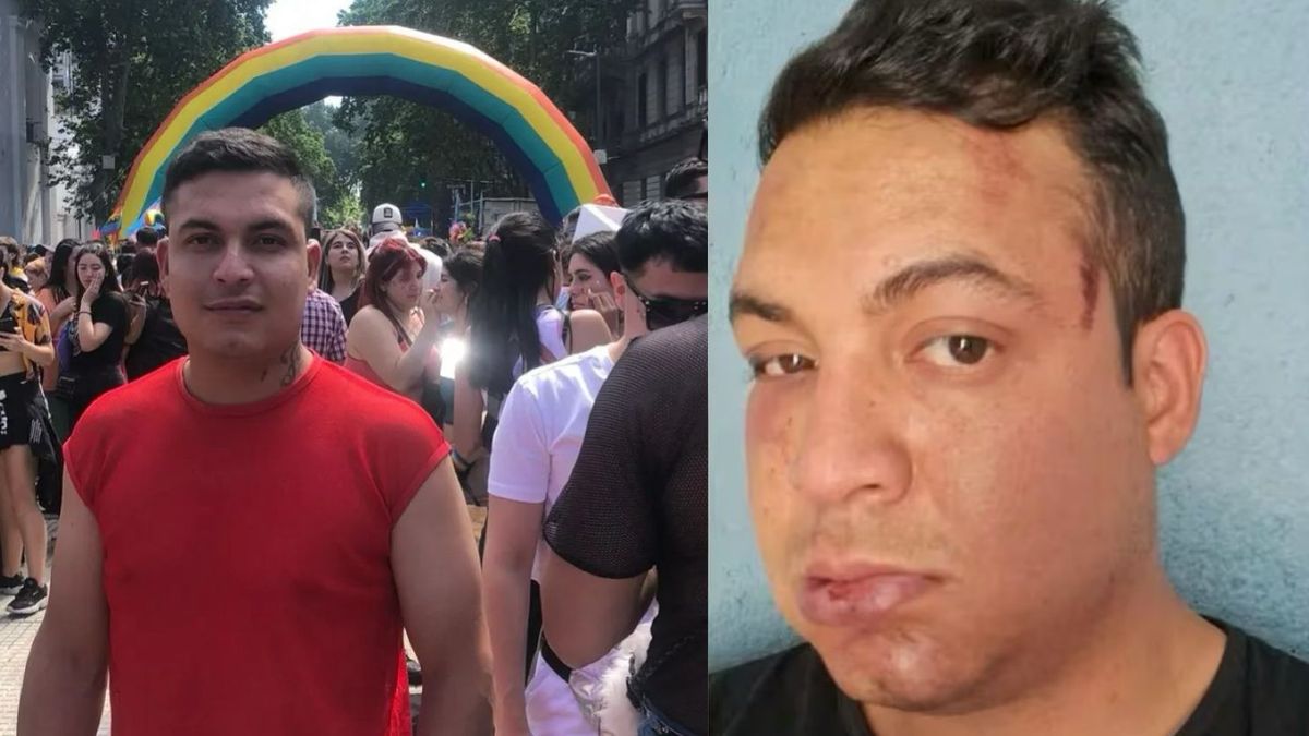 Brutal ataque homofóbico de una patota a un joven que volvía de la marcha del orgullo (Foto: Facebook Facu Sayavedra)