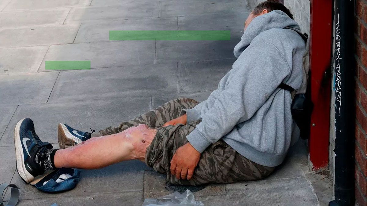 Un adicto a la xilicina, tirado en una calle de Londres con una grave infección en una de sus piernas (Foto: gentileza The Mirror).