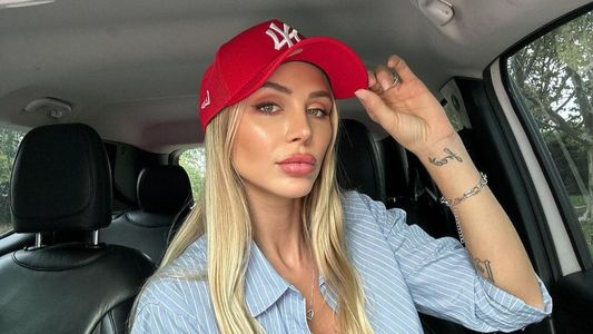 El drama de Romina Malaspina tras una sustancia que arruinó sus labios: No se lo hagan