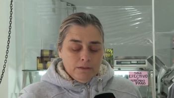El crudo relato de la mamá del nene baleado en la cara: Me llamó y me dijo me pegaron un tiro