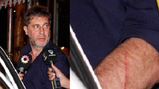 El marido de Florencia de la V confirmó la agresión de Gianola