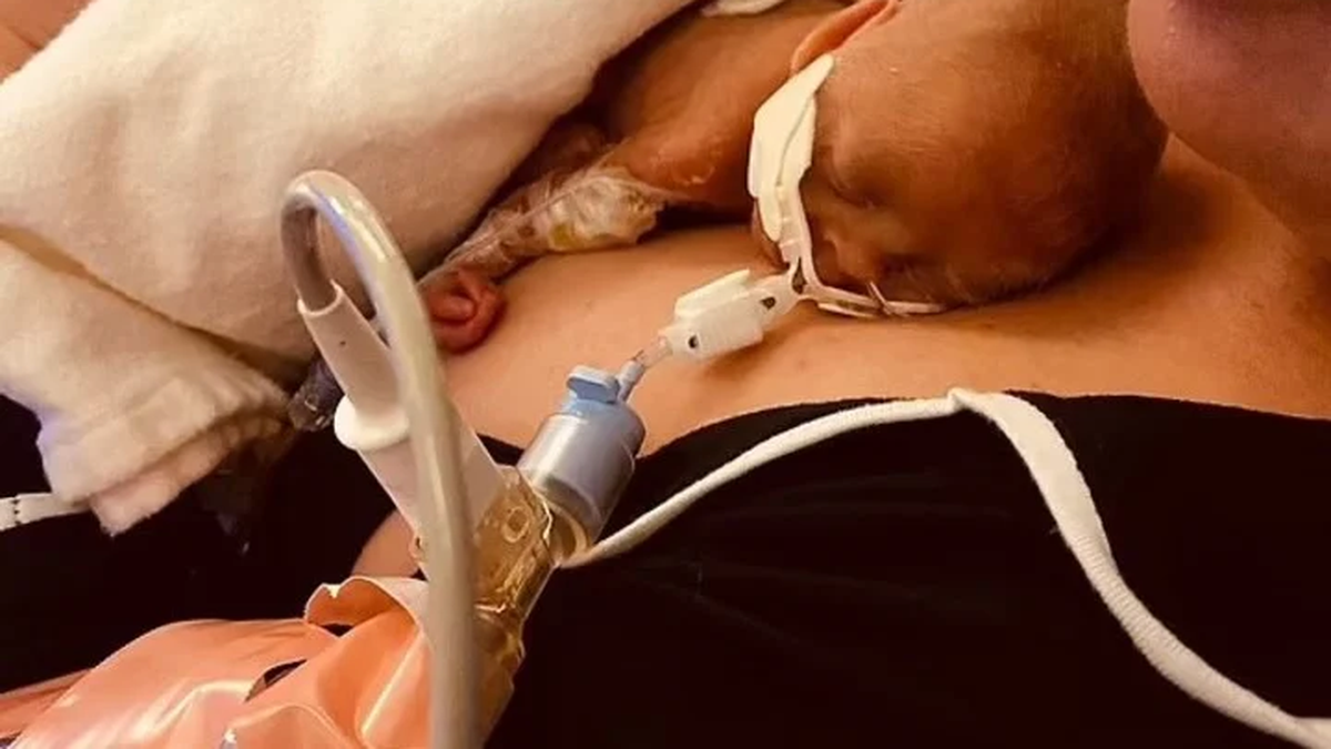 El milagro de los beb&eacute;s m&aacute;s prematuros del mundo: Nacieron a la 22 semanas&nbsp;