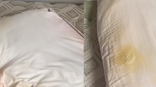 Mostró el truco definitivo para sacarle las manchas amarillentas a las almohadas