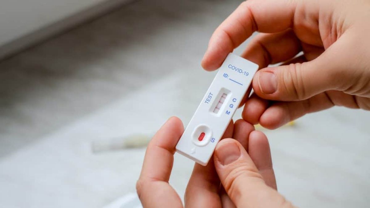 El Gobierno reguló este martes la venta y la utilización de los denominados autotest de coronavirus en farmacias (Foto: archivo).