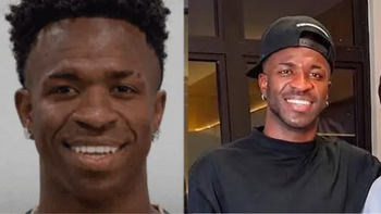Cambio radical: los detalles sobre la cirugía estética de Vinícius Jr. que sorprende a todos