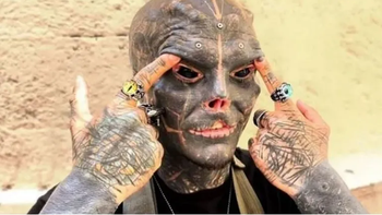 Se operó todo porque quiere ser un alien