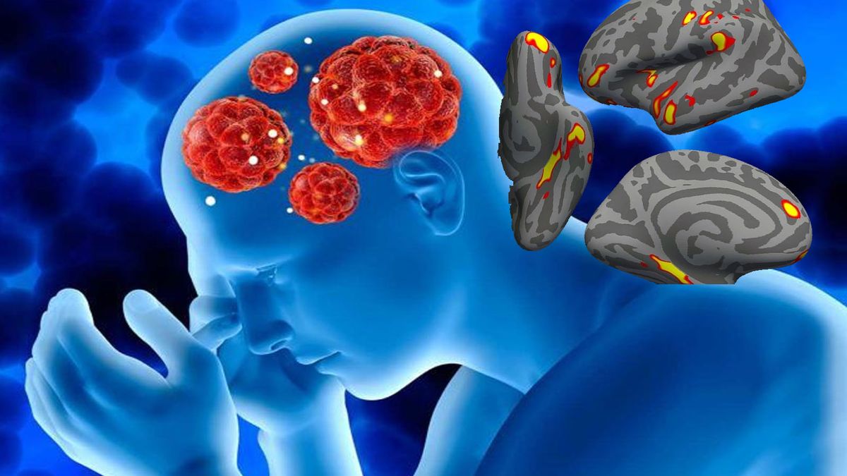 Un estudio demostró que personas con Covid, pero sin vacunación, tienen problemas en el cerebro a largo plazo. (foto: BiotechMag)