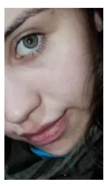 Discutió con su novia, la roció con aguarrás y la prendió fuego: está grave
