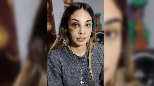Liberaron al hombre que desfiguró a su pareja y ella se descargó en las redes: ¿Tengo que aparecer muerta?