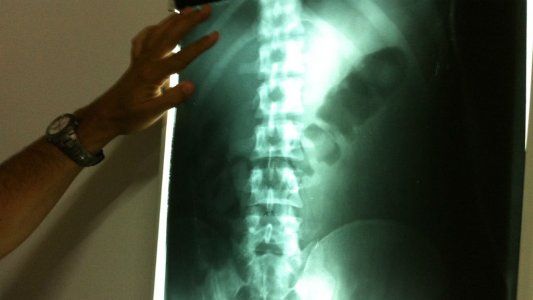 La impactante historia de una mula del narcotráfico: droga en pañales de la hija, entrenamiento digestivo y nervios en la frontera