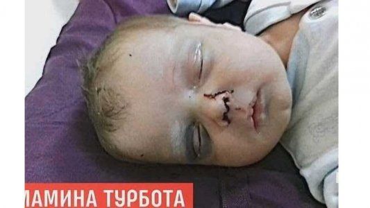 Encontraron a un bebé golpeado y al borde de la muerte: su madre lo dejó para ir a una “cita”