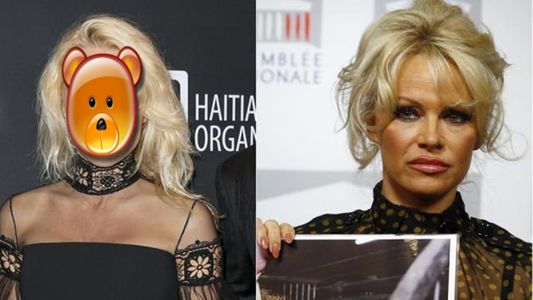 ¡Mirá el nuevo rostro de Pamela Anderson!