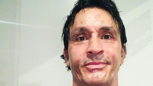 Sebastián Estevanez habló del accidente doméstico que tuvo: Me confié, cometí un error