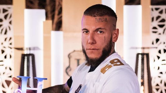 La nueva foto de Alex Caniggia tras operarse la mandíbula: Cada día estoy más facha