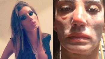 Natacha Jaitt denunció que su ex la golpeó en la calle