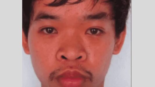 No conseguía trabajo por feo, se hizo 9 cirugías y ahora se gana la vida como modelo