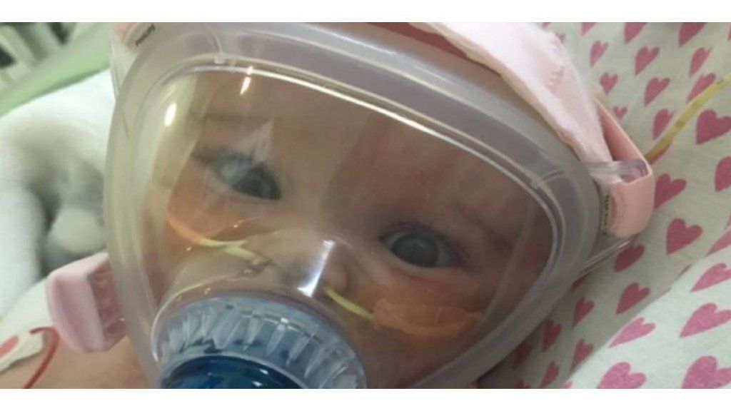 Bebé de 6 meses superó cirugía de corazón abierto y el coronavirus
