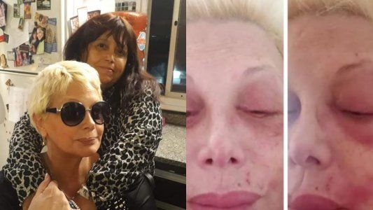 Marcela la “brujita de Quilmes” que le curó a Carmen Barbieri de la culebrilla: “Ahora le quedó una parálisis facial”
