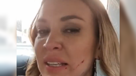 Dallys Ferreira tras ser agredida por una mujer en la calle: Mi hija presenció todo