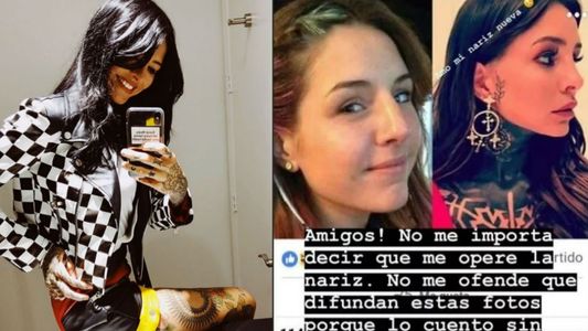 Candelaria Tinelli habló de la cirugía estética en su cara