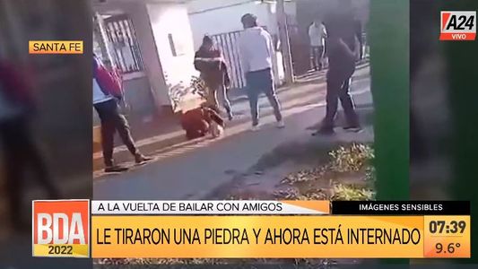 Santa Fe: brutal ataque con una piedra a un joven y está grave