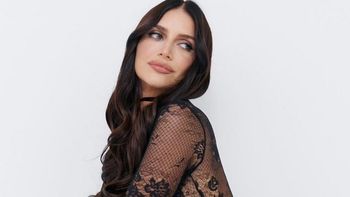 El doloroso accidente de Zaira Nara que casi la desfigura: La belleza duele