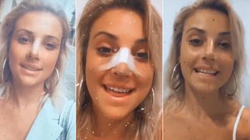 Bianca Iovenitti lució su nariz después de la cirugía estética