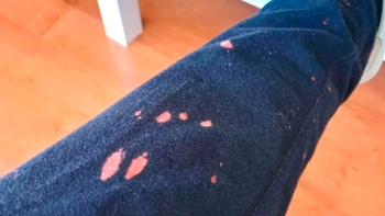 Eliminando las manchas de lavandina: trucos efectivos revelados
