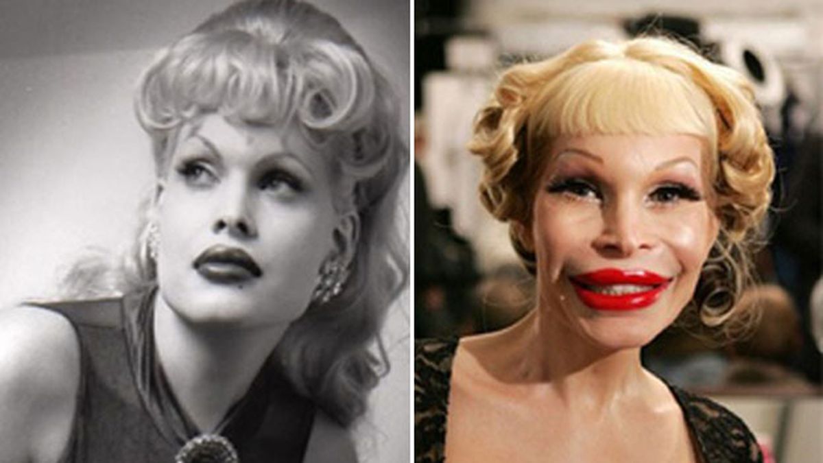 Amanda Lepore