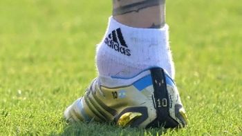 Así está el tobillo de Messi a un día del debut de la Selección Argentina en Qatar 2022. Así está el tobillo de Messi a un día del debut de la Selección Argentina en Qatar 2022.