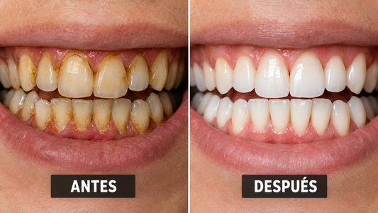 Ni vinagre ni bicarbonato: este es el mejor MÉTODO para eliminar el sarro de los dientes y dejarlos con BRILLO