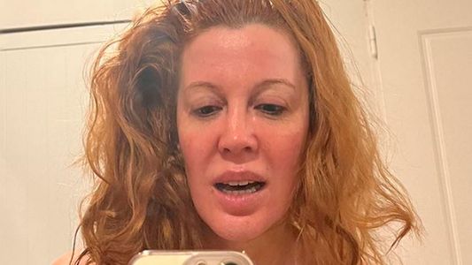 Miriam Lanzoni sufrió un fuerte accidente por el que casi pierde un ojo