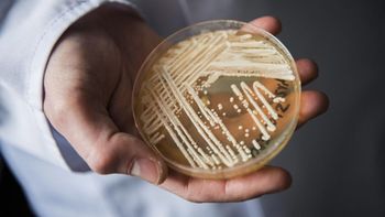 Qué es el Candida Auris, el hongo mortal cada vez más resistente a los medicamentos
