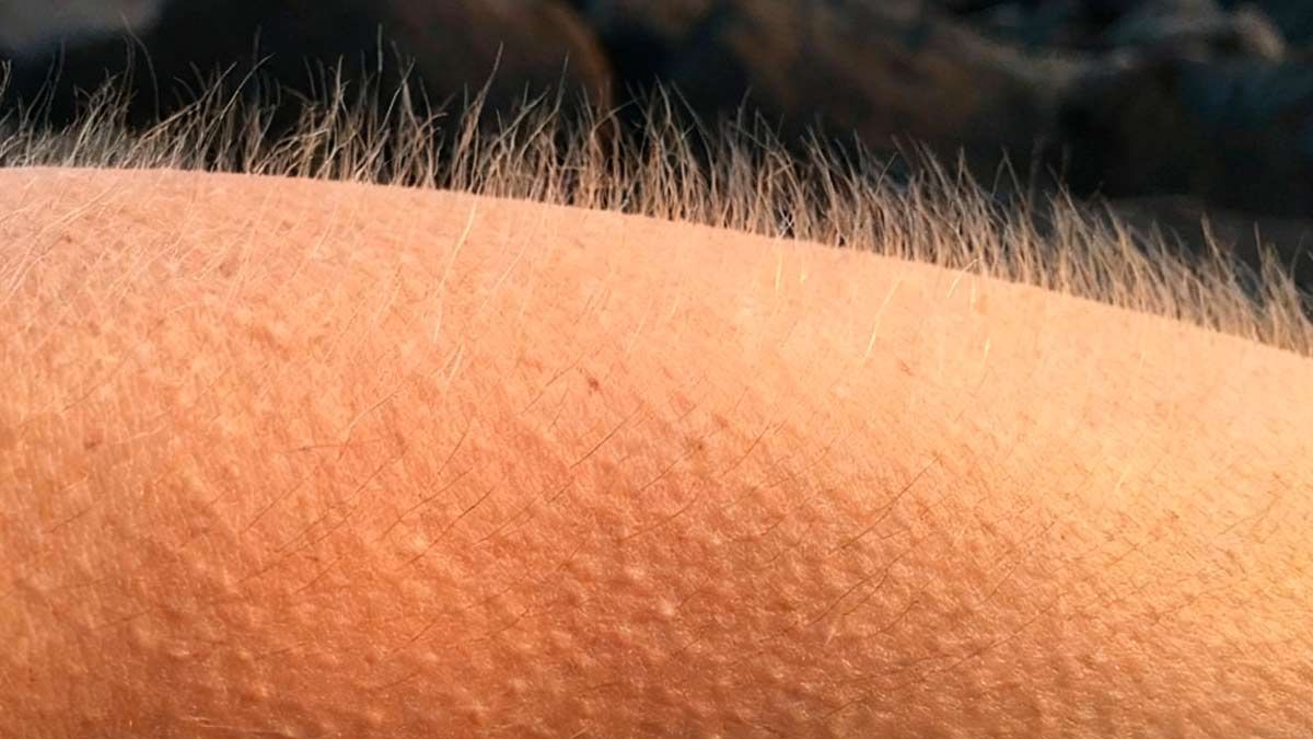 La piel de gallina es una reacción involuntaria del cuerpo que puede aparecer ante el frío o distintas emociones.