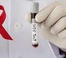 El Senado aprobó la nueva Ley de VIH, tuberculosis y hepatitis: qué cambios contempla
