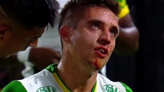 Polémica en Boca-Defensa: Romero le pegó un codazo a Gutiérrez que lo dejó sangrando y el VAR no intervino