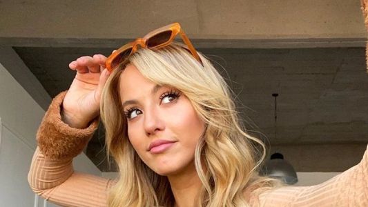 Flor Vigna generó preocupación por su estado de salud en las redes