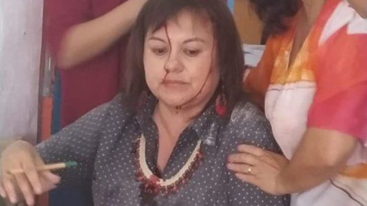 Se salvó de milagro: una docente resultó herida en una escuela luego de que se le cayera parte del techo