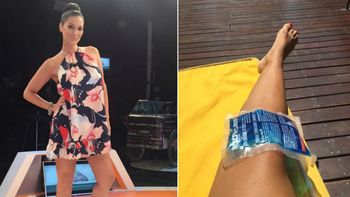 Silvina Escudero: Ensayando me volví a lesionar la rodilla
