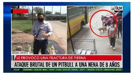 San Miguel: un pitbull atacó a una nena de 8 años y el dueño no aparece