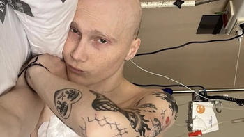 Murió Charlie: tenía 20 años y mostró el día a día de su cáncer en TikTok