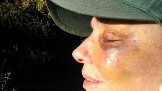 Así quedó Graciela Borges tras el accidente
