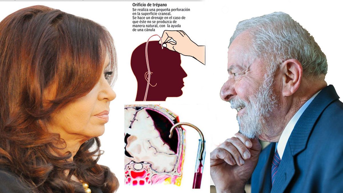 Lula da Silva sufrió una lesión comparable a la de Cristina Fernández de Kirchner. (Foto: A24.com)