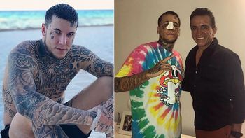 Alexander Caniggia se operó la cara: qué se hizo