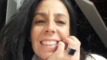 Julieta Bal pasó por el quirófano: qué se hizo