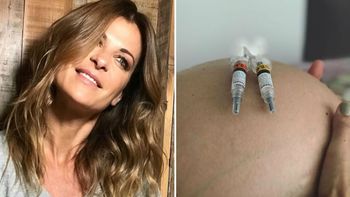 Fuerte imagen de Eugenia Tobal del tratamiento de la trombofilia: 265 pinchazos